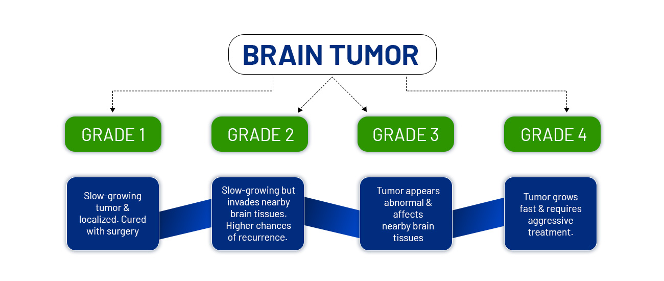 Here are five things to understand about brain tumors