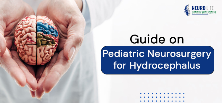 Guide on Pediatric Neurosurgery for Hydrocephalus (1)