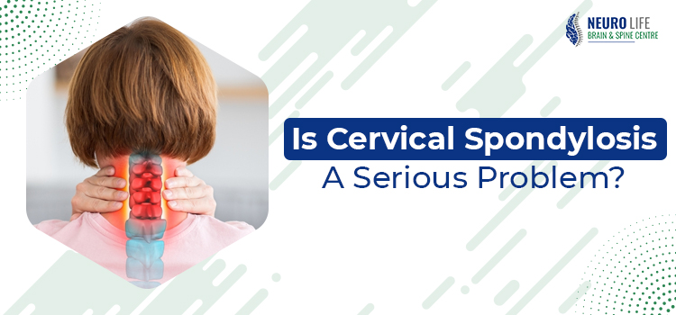 Is Cervical Spondylosis A Serious Problem