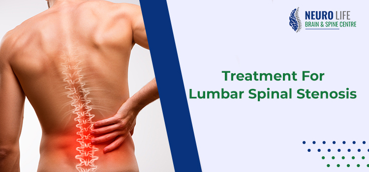 Treatment For Lumbar Spinal Stenosis