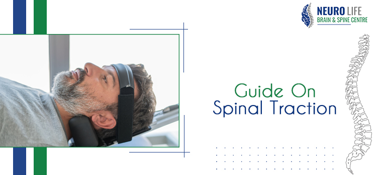 Everything you need to know about spinal traction for neck and back pain