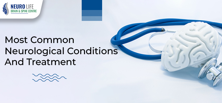 Most-Common-Neurological-Conditions-And-Treatment