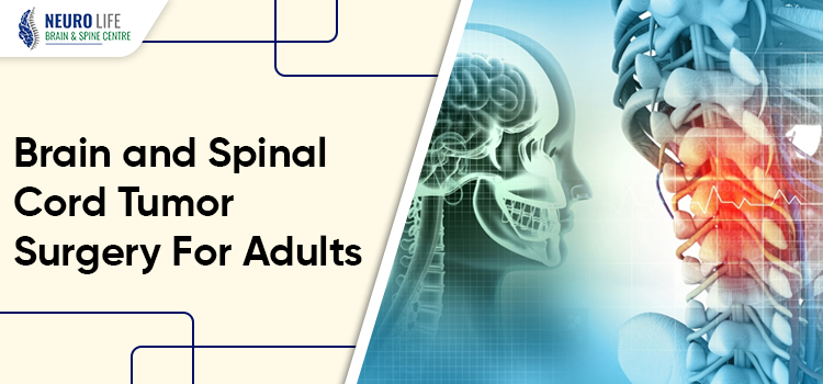 Guide on the brain and spinal cord tumor surgery for adults