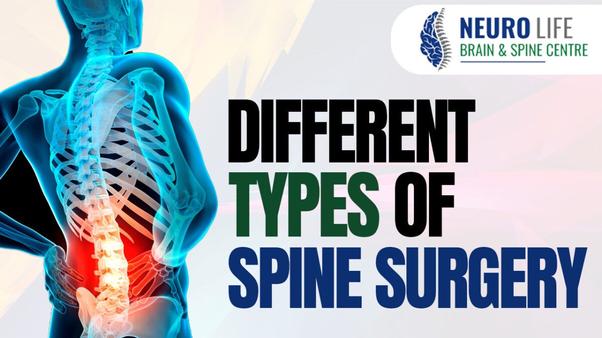 Different types of Spine surgery