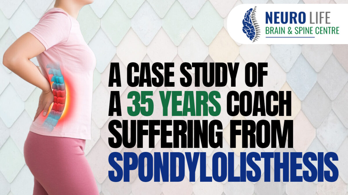 A case study of a 35 years coach suffering from spondylolisthesis