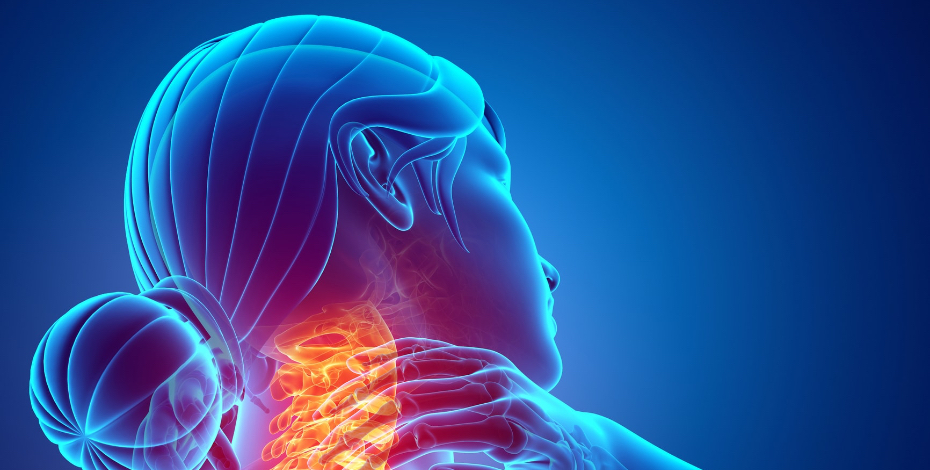Quick Guide to Cervical Radiculopathy
