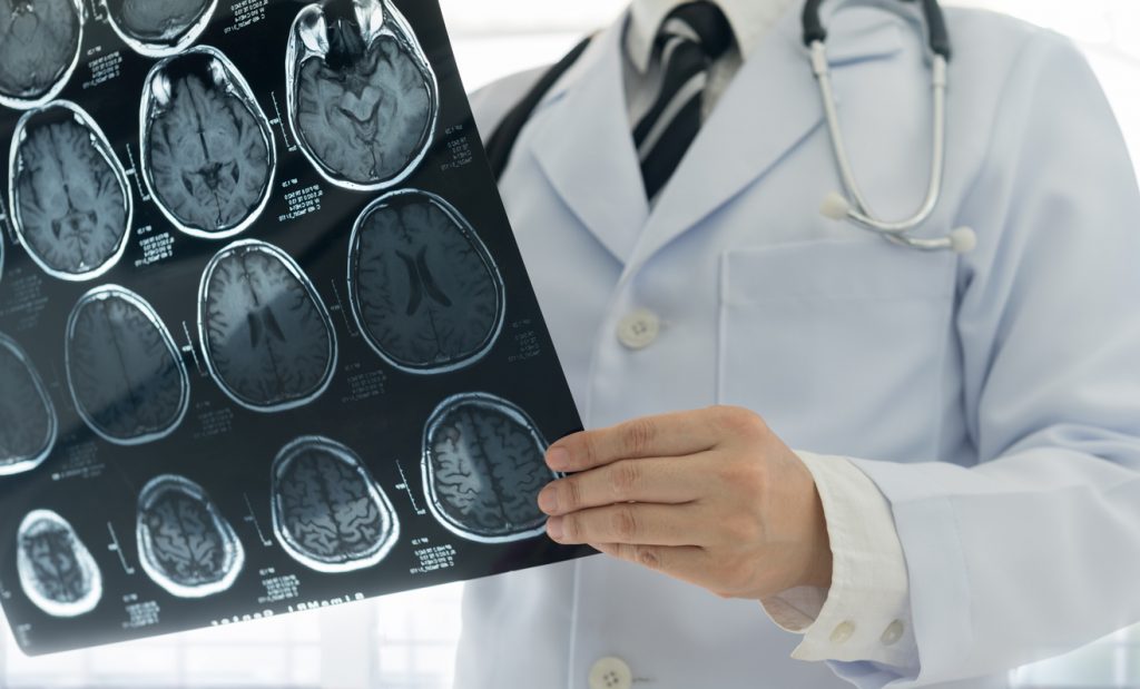 5 Tips to Find the Right Neurologist for Your Nerve Issues