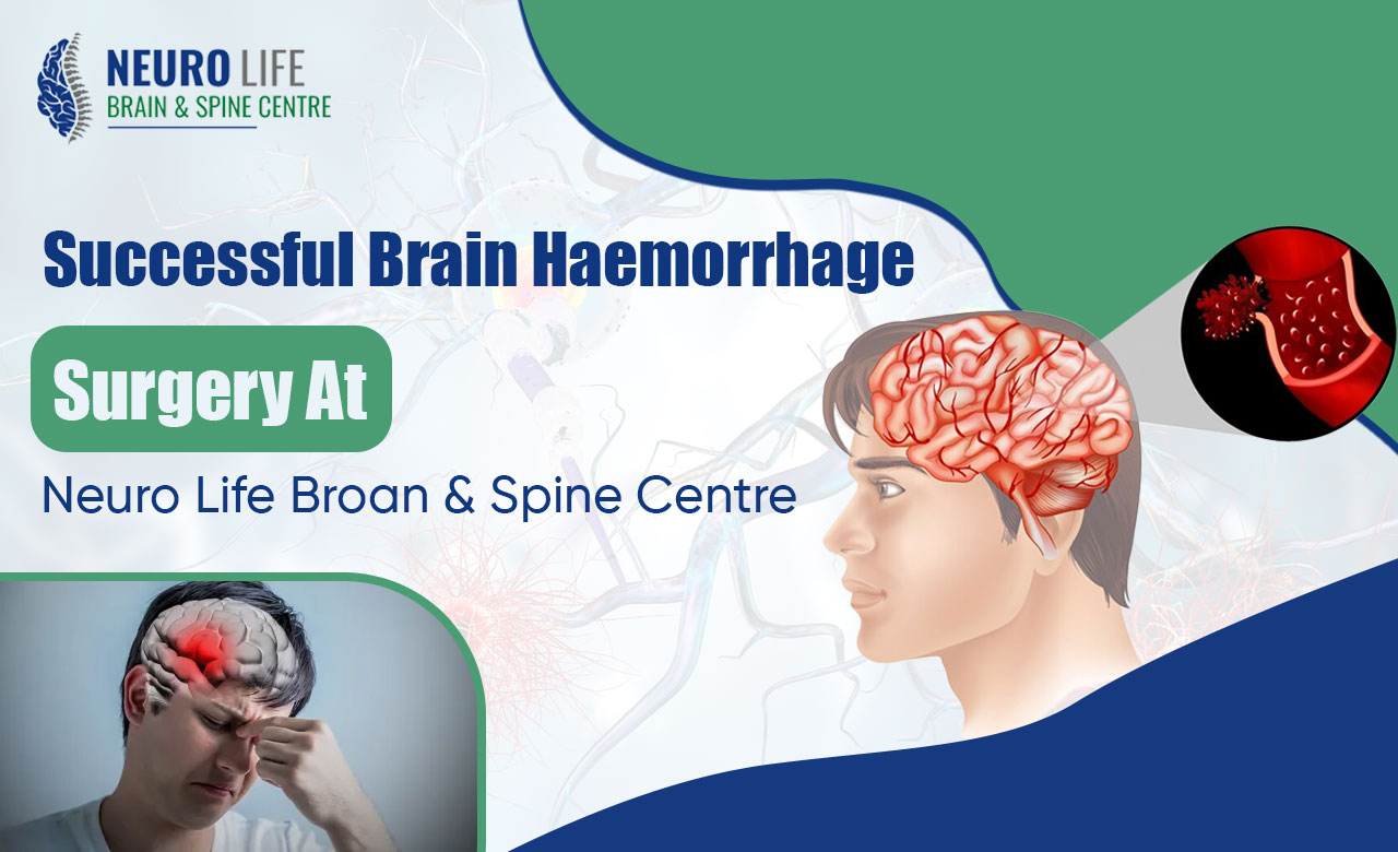 Successful Brain Haemorrhage Surgery At Neuro Life Broan & Spine Centre