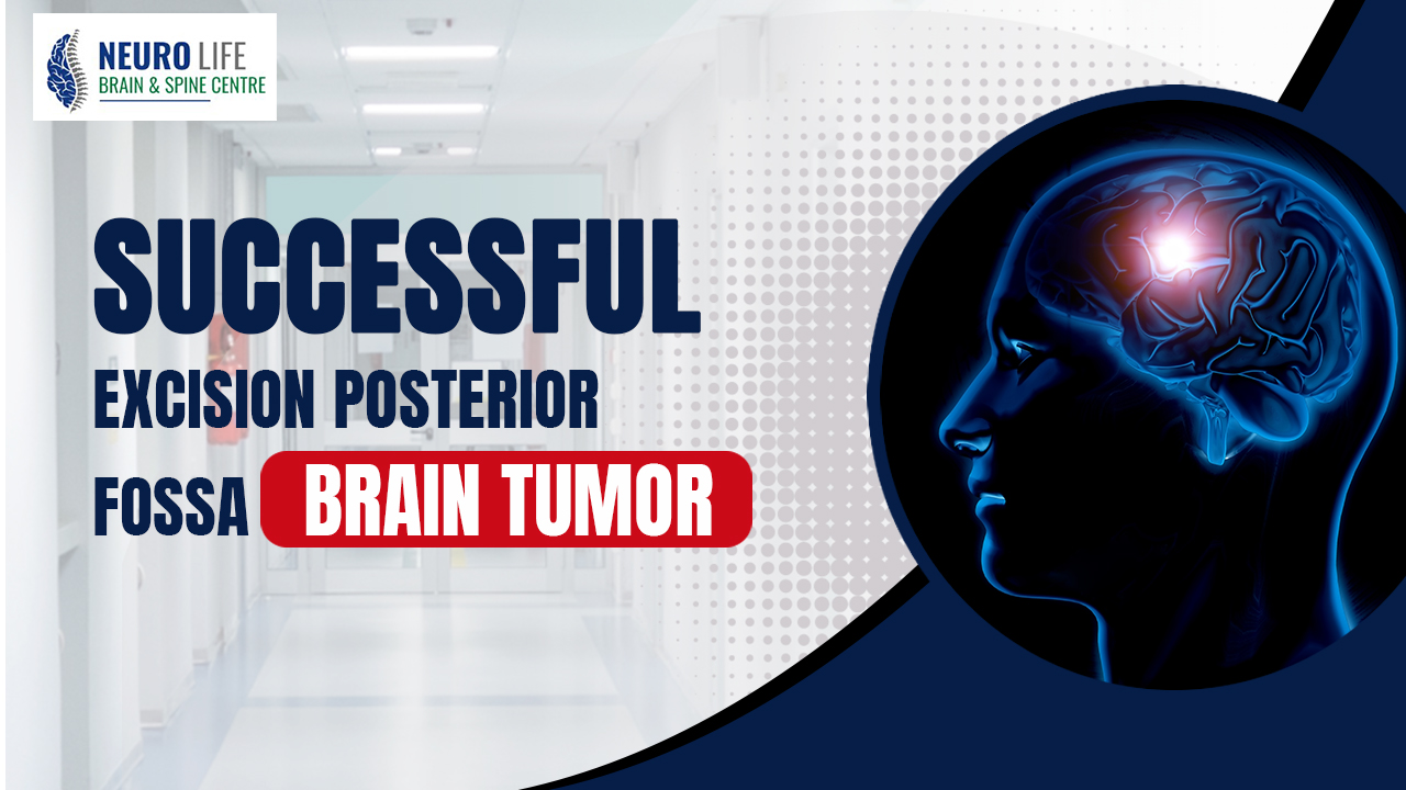Successful excision Posterior Fossa Brain Tumor